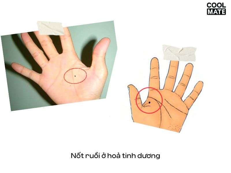Vị trí nốt ruồi lòng bàn tay nam
