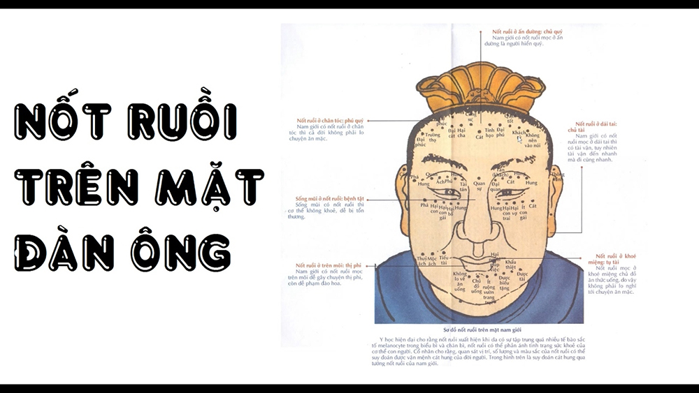 Nốt ruồi phú quý trên mặt đàn ông