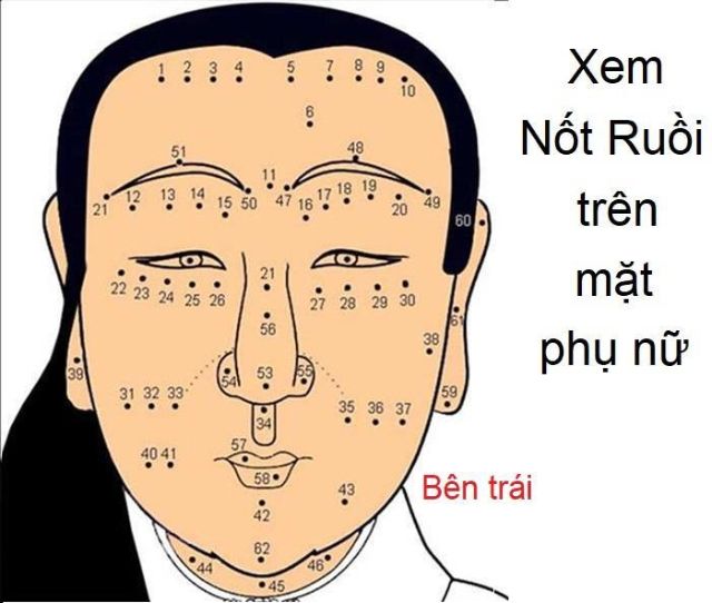 Bản đồ các vị trí nốt ruồi trên mặt