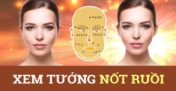 Các vị trí nốt ruồi thường gặp
