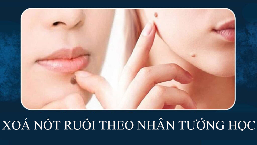 Xoá nốt ruồi theo nhân tướng học
