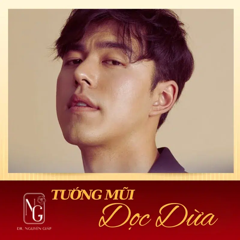 Hình minh họa mũi dọc dừa ở người
