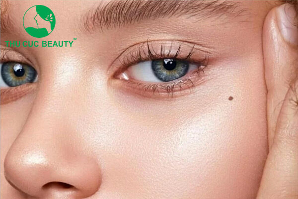 Những nốt ruồi không nên tẩy trên mặt