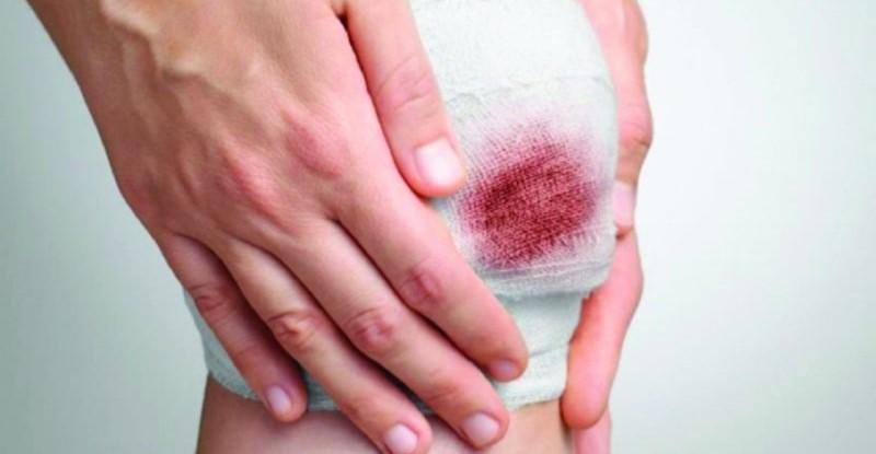 Mơ thấy mình chảy máu nên đánh đề số mấy
